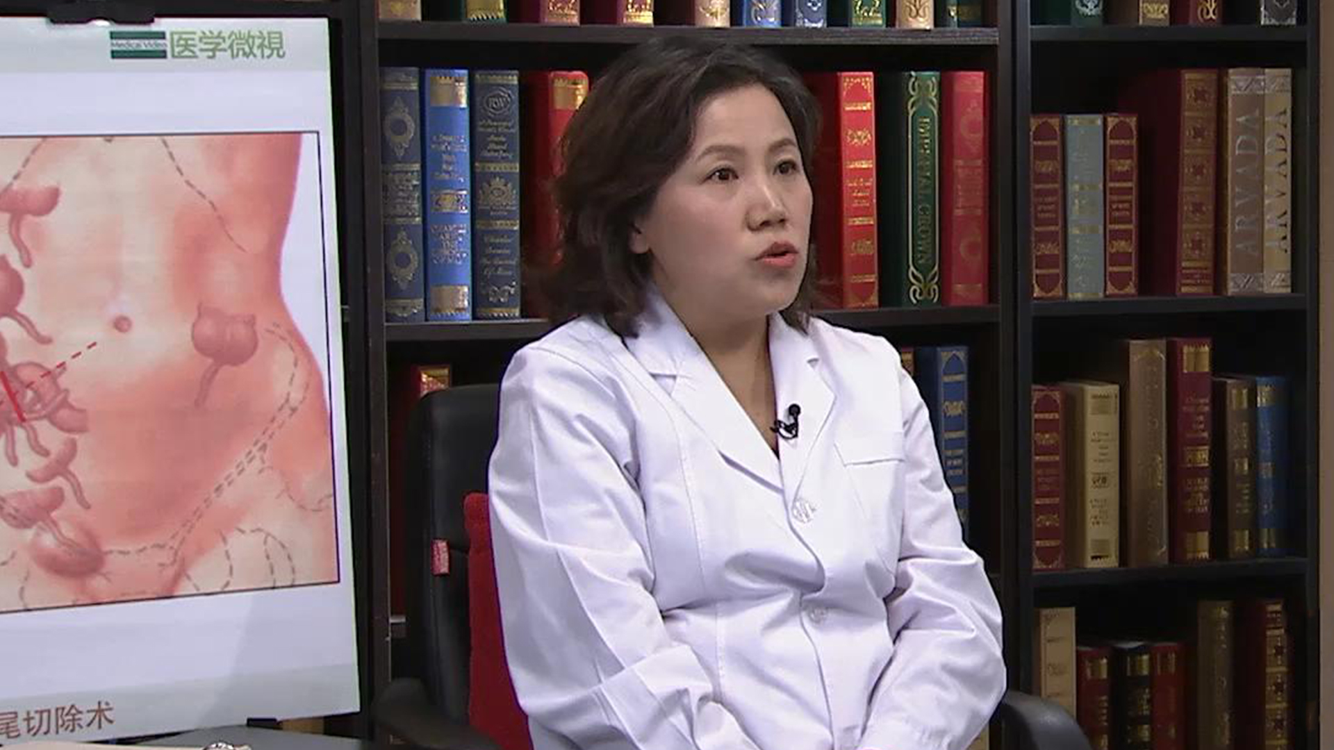 刘婷婷